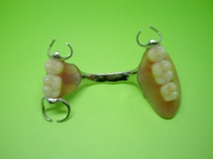 保険義歯（DSシステムを応用したレジン床・熱可塑性樹脂）