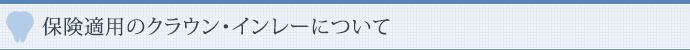 保険適用のクラウン・インレーについて